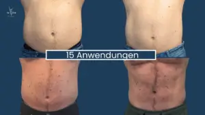 Muskelaufbau Abnehmen im Liegen Wien 10