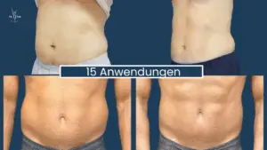 Muskelaufbau Abnehmen im Liegen Wien 11