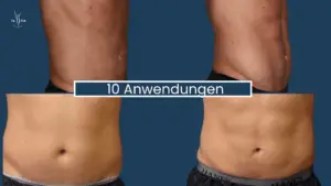 Muskelaufbau Abnehmen im Liegen Wien 12