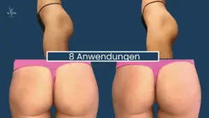 Muskelaufbau Abnehmen im Liegen Wien 14