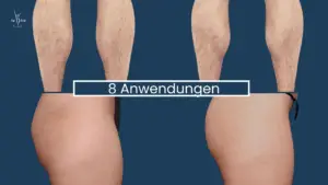 Muskelaufbau Abnehmen im Liegen Wien 18