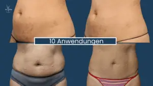 Muskelaufbau Abnehmen im Liegen Wien 2