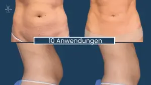 Muskelaufbau Abnehmen im Liegen Wien 3