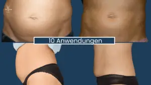 Muskelaufbau Abnehmen im Liegen Wien 4