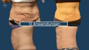 Muskelaufbau Abnehmen im Liegen Wien 6