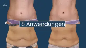 Muskelaufbau Abnehmen im Liegen Wien 8