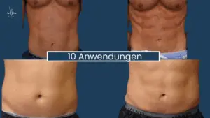 Muskelaufbau Abnehmen im Liegen Wien 9